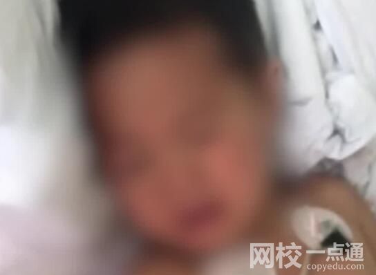 3歲男童路遇烈犬掙脫狗繩撕咬 背后真相實在讓人驚愕