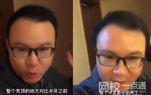 男子回應“不用洗發水變滿頭黑發” 具體是什么情況?