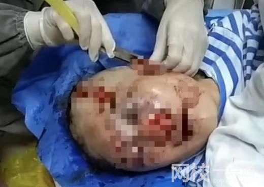 在公廁被打女子回應:沒有衣著暴露 事件具體經過是什么?