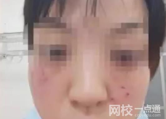 家長(zhǎng)帶娃道歉被打 打人者被拘10日 具體是什么情況?