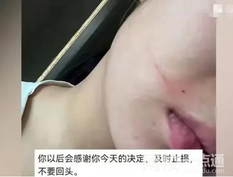 女子懷孕近7個月被丈夫施暴 具體是什么情況?
