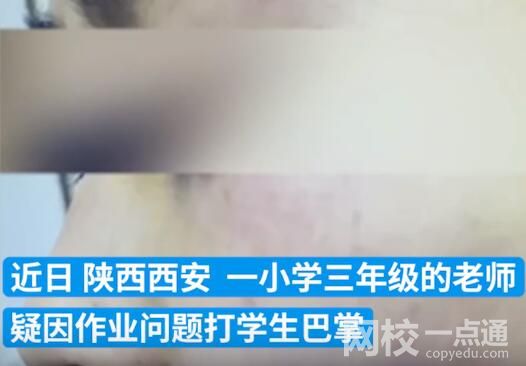 連扇學生數十耳光涉事老師被拘 背后真相實在讓人驚愕
