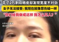 女子花2萬(wàn)割雙眼皮控訴成了悲傷蛙 實(shí)在太悲劇了