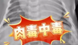 52天嬰兒喝奶奶喂的蜂蜜水中毒進ICU 究竟是怎么回事？
