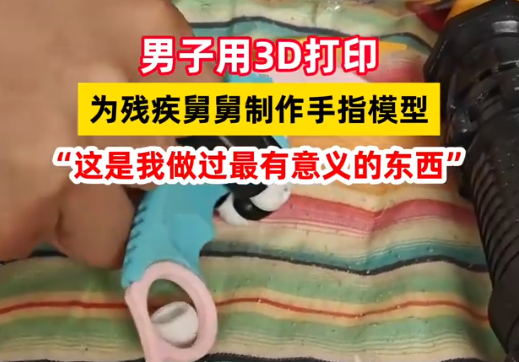 男子用3D打印幫舅舅補上斷指 這也太暖心了
