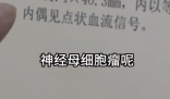 女孩因個(gè)矮去體檢發(fā)現(xiàn)腎上長(zhǎng)腫瘤 這也太恐怖了