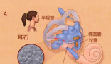 25歲女子長(zhǎng)期熬夜打麻將患耳石癥 究竟是怎么回事？