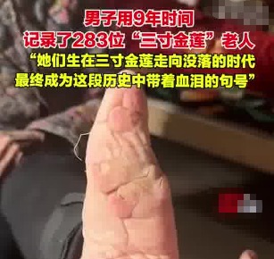 男子用9年時間記錄了283位裹腳老人 為什么引爭議？