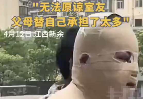 全身90%燒傷男生說(shuō)父母借錢太心酸 究竟是怎么回事？
