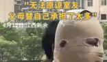 全身90%燒傷男生說父母借錢太心酸 究竟是怎么回事？