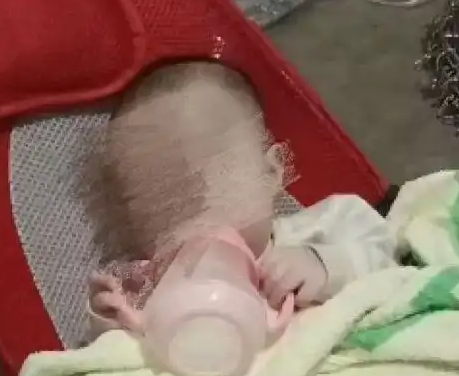 8個月女嬰被餓成皮包骨 當地回應 到底是什么情況？