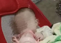8個月女嬰被餓成皮包骨 當地回應 到底是什么情況？