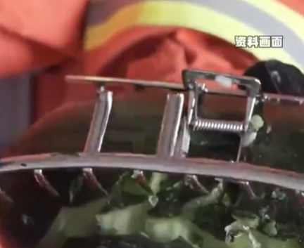 女子戴鯊魚夾騎電車摔倒致頭骨骨折 實(shí)在太悲劇了